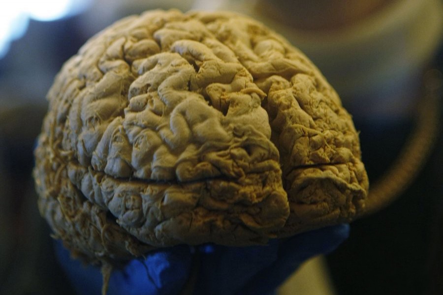 Scientists find how brain encodes speech