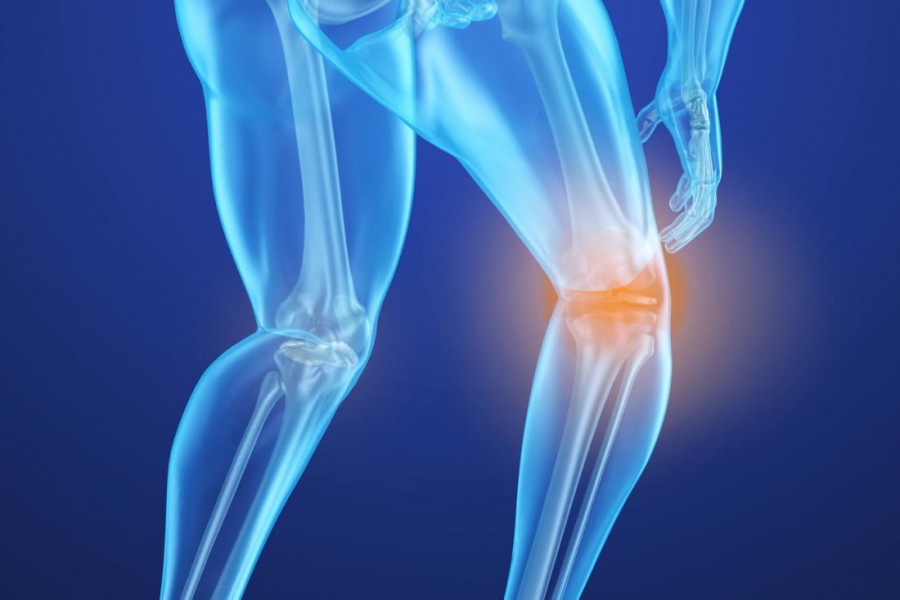 20m suffer from bone erosion