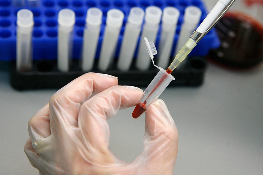 A laboratory technician examines blood samples for HIV/AIDS at a hospital — Reuters/Files