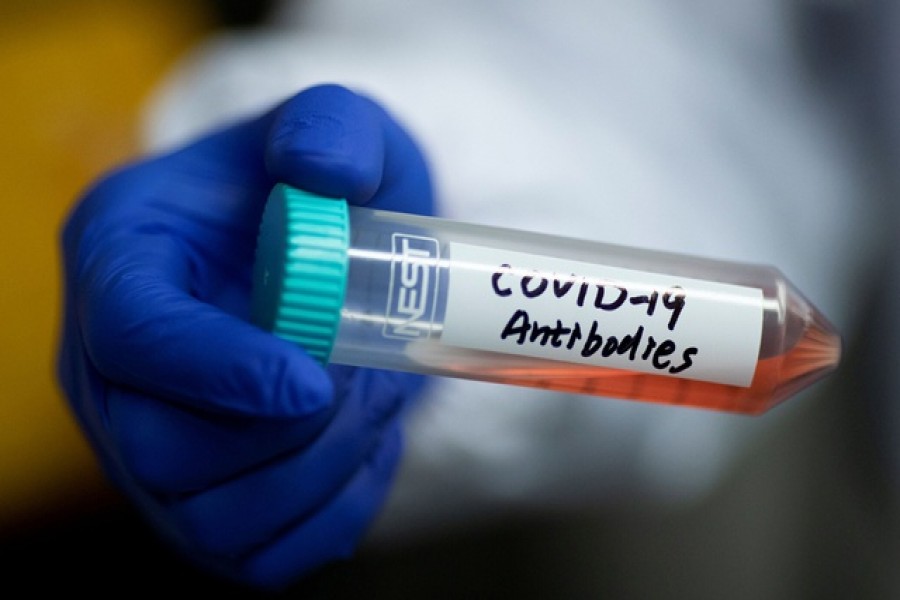 Israel claims 'breakthrough' in coronavirus treatment