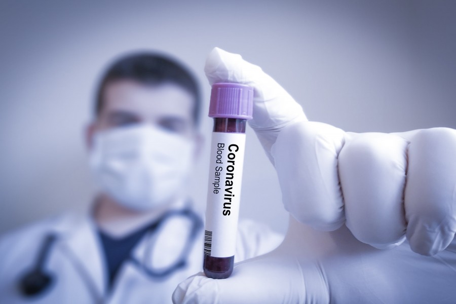 COVID-19 testing lab for RMG workers launched