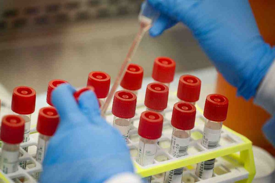 NTAC suggests PCR, antigen, antibody tests at once