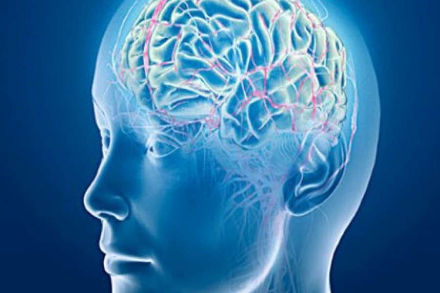 Representational Image