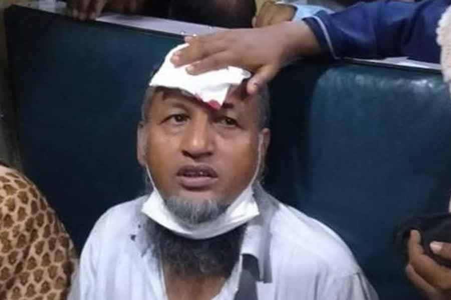 চলন্ত ট্রেনে ছোড়া পাথরের আঘাতে আহত এ যাত্রী