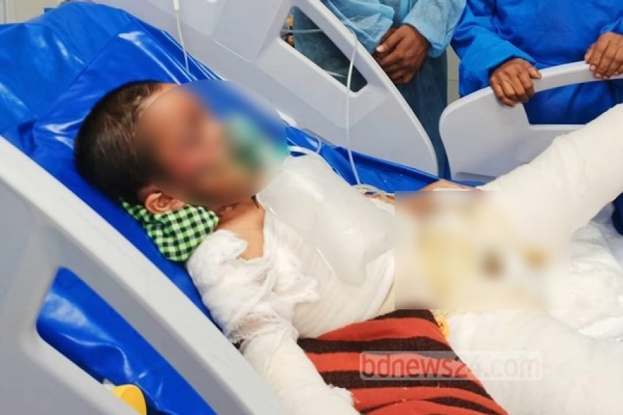 কুমিল্লায় বিস্ফোরণ: ১৭ দিন লড়াই করে মৃত্যুর কাছে হারল সাব্বির