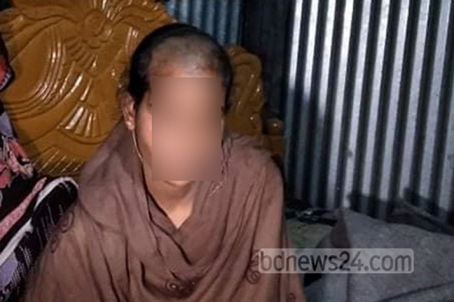 ‘যৌতুক না পেয়ে’ স্ত্রীর চুল কেটে দিলেন স্বামী, আটক ননদ