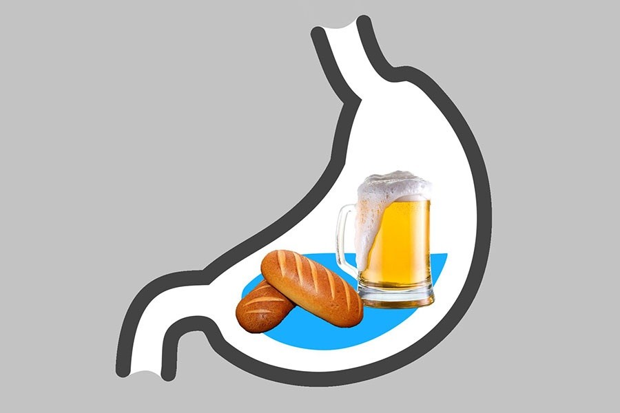 অটো ব্রিউয়ারি সিনড্রোম: অ্যালকোহল না খেয়েই যখন মাতলামি