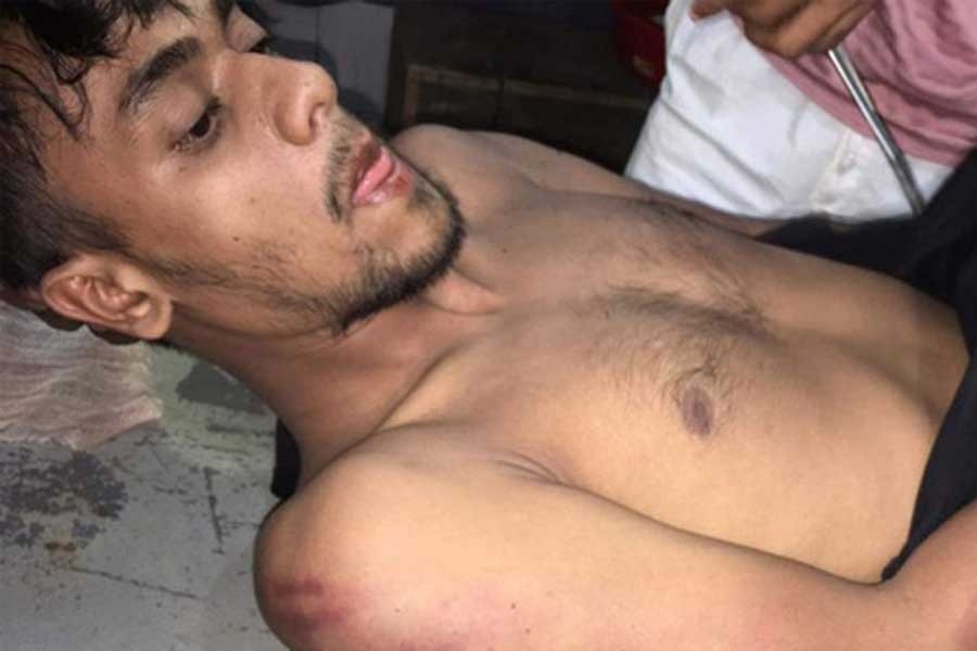 ‘কোচিং না করায়’ শিক্ষার্থীকে রড দিয়ে পিটিয়ে জখম