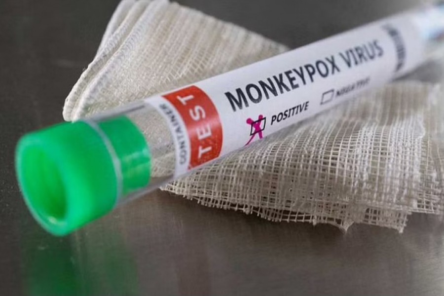 মাঙ্কিপক্স: সমকামী পুরুষদের যৌনসঙ্গী কমাতে পরামর্শ ডব্লিউএইচও মহাসচিবের