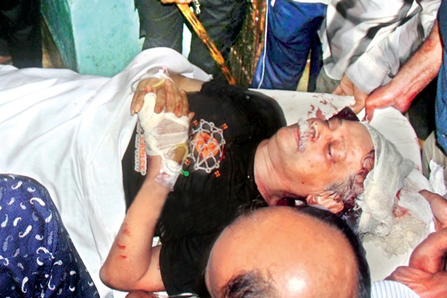 Prof Zafar Iqbal comes under knife attack