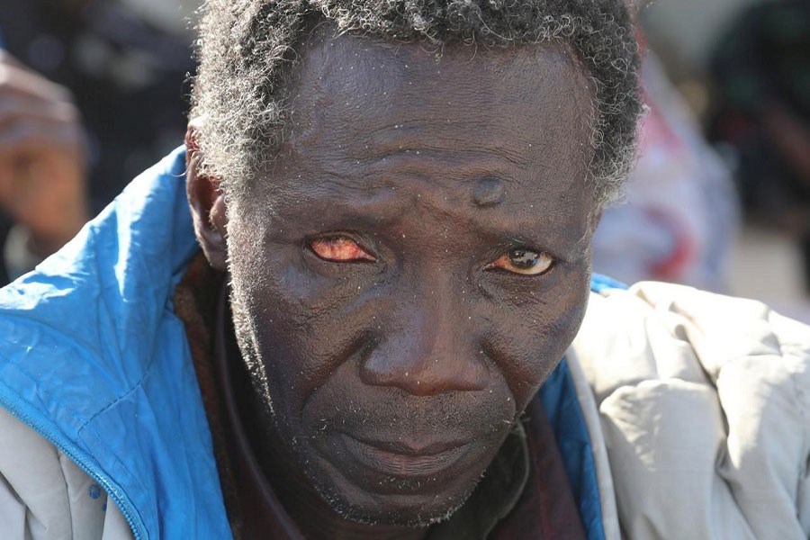 A migrant is seen at a naval base after being rescued by the Libyan coast guard in Tripoli, Libya March 10, 2018. Reuters