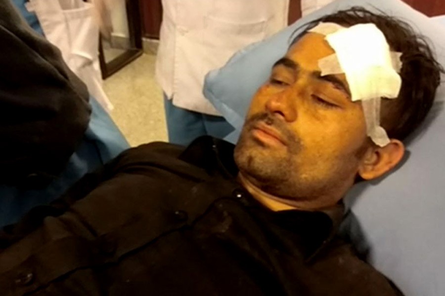 I am fortunate to be alive, says a survivor