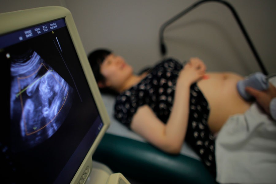 A woman attends a sonogram at a local hospital in Shanghai September 12, 2014. Reuters/File