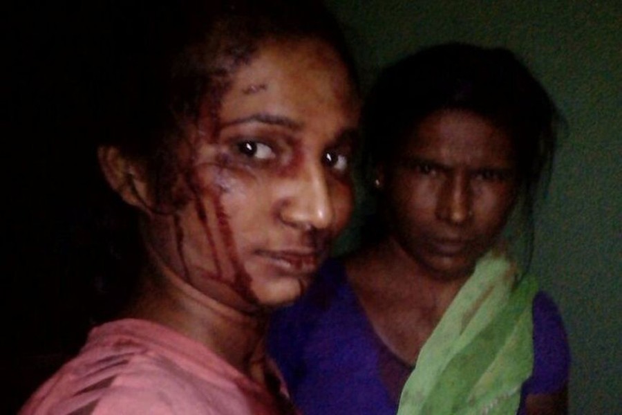 Rupali Meshram took a selfie with her mother soon after the attack