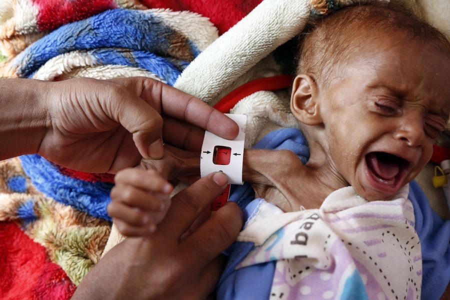 Over 5,000 children killed, injured in Yemen war: UNICEF