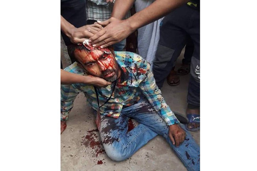 Dhaka city polls: Three journalists injured in attacks