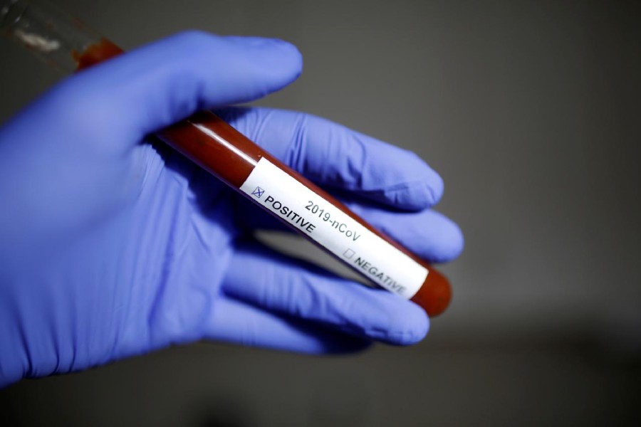 Three more coronavirus deaths, 54 new cases in Bangladesh