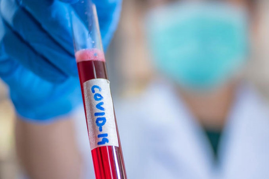 Jamuna TV reporter tests positive for coronavirus