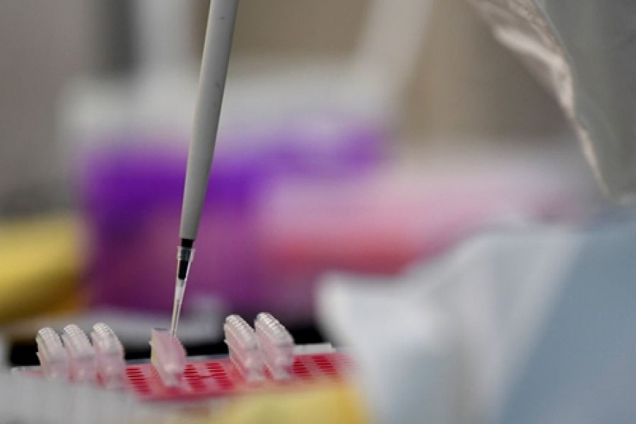 16 journalists tested positive for coronavirus: DUJ