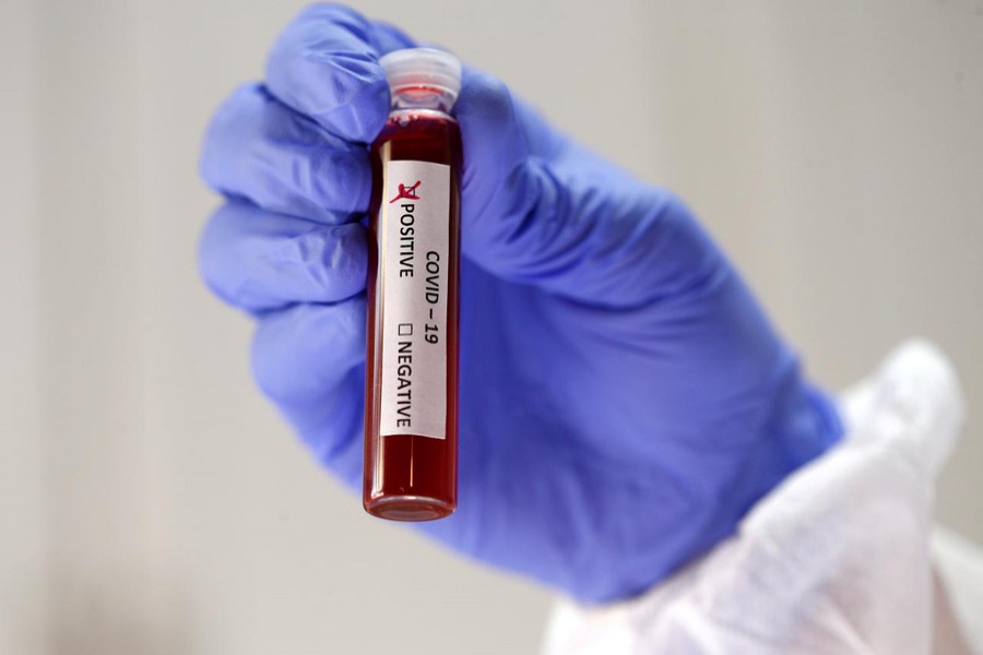 Millions at risk as testing capacity remains very low