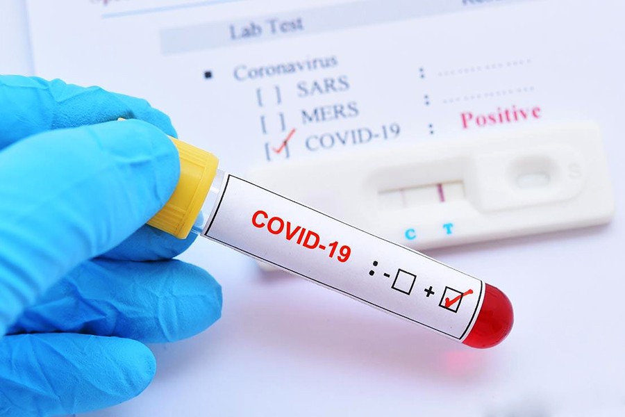 Six test positive for Covid-19 in Nilphamari