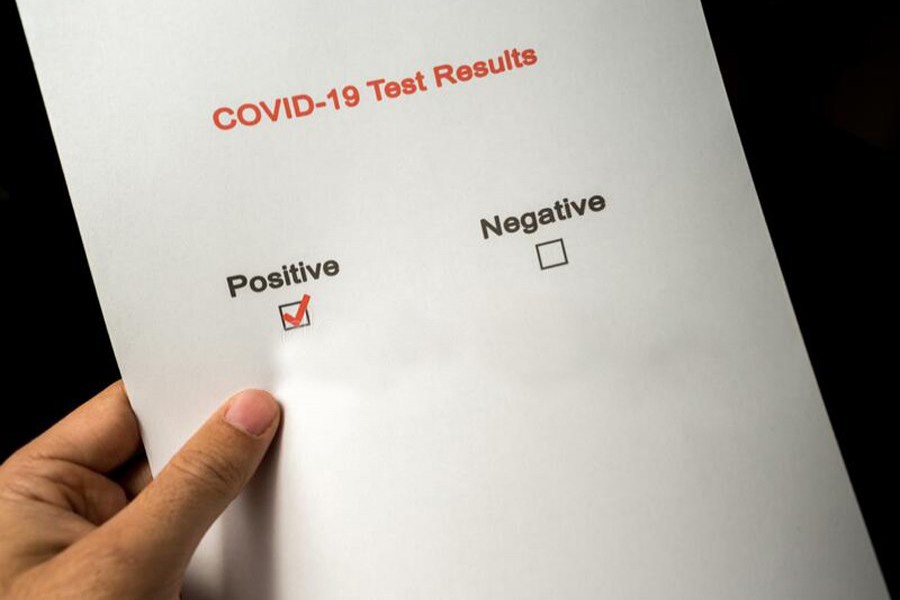 Kushita man tests Covid positive without providing sample for test