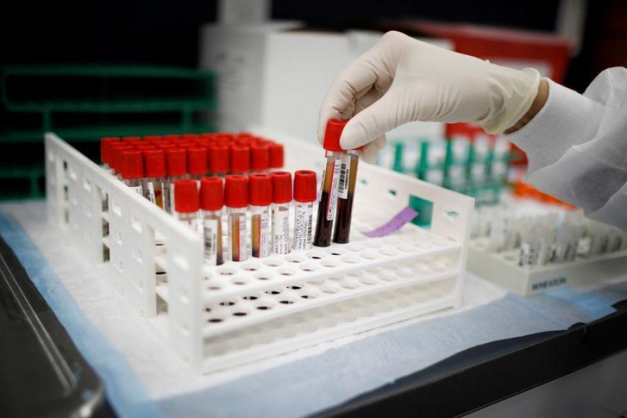 A health worker takes test tubes with plasma and blood samples after a separation process in a centrifuge during a coronavirus disease (Covid-19) vaccination study at the Research Centers of America, in Hollywood, Florida, US on September 24, 2020 — Reuters/Files