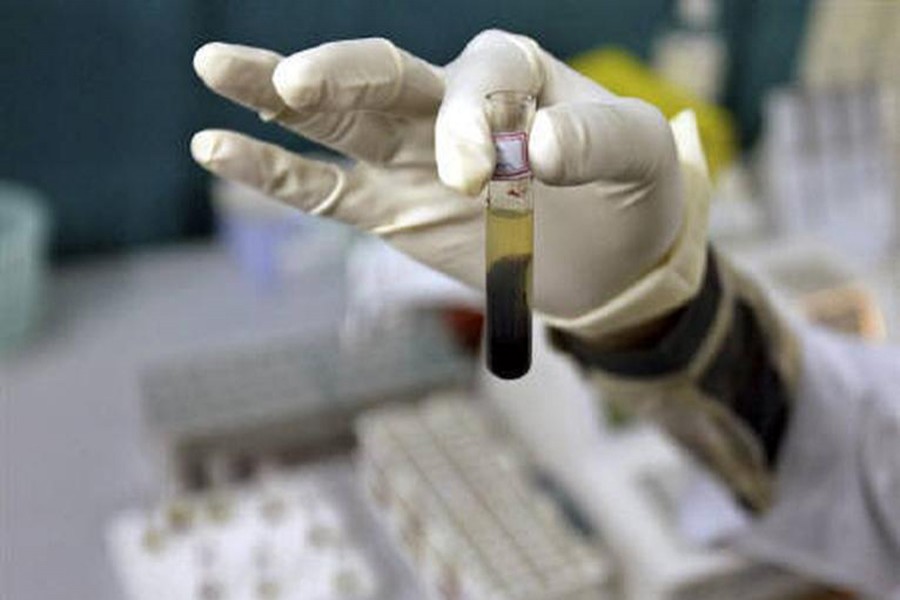 A laboratory assistant examines a blood sample inside a laboratory — Reuters/Files