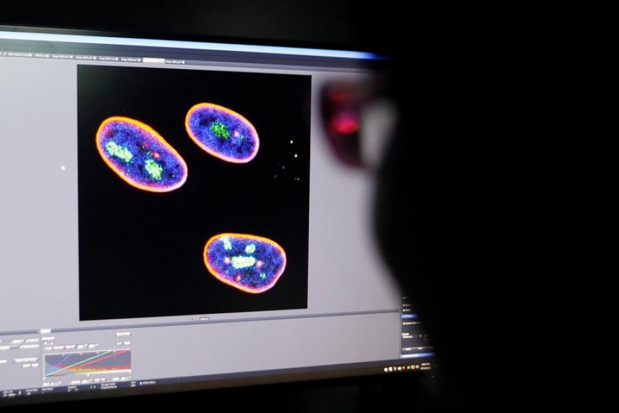 A researcher observes the confocal image on a screen showing the nucleus of human stem cells after KAT7 intervention, in the Aging and Regeneration lab at the Institute for Stem Cell and Regeneration of the Chinese Academy of Sciences (CAS) in Beijing, China on January 12, 2021 — Reuters/Files