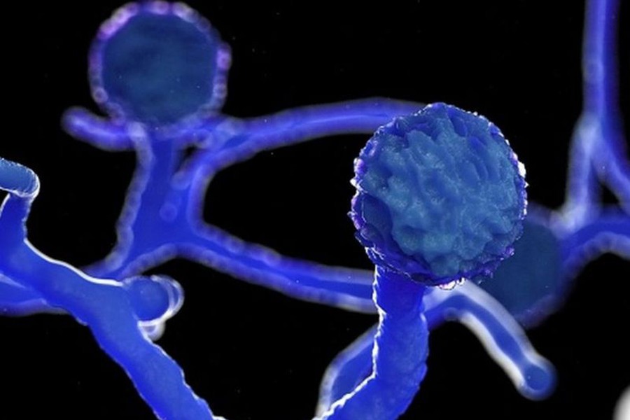 One dies of suspected black fungus infection in capital