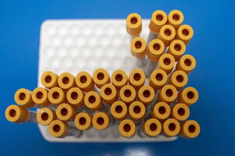 Coronavirus inoculation sans antibody test groping in dark